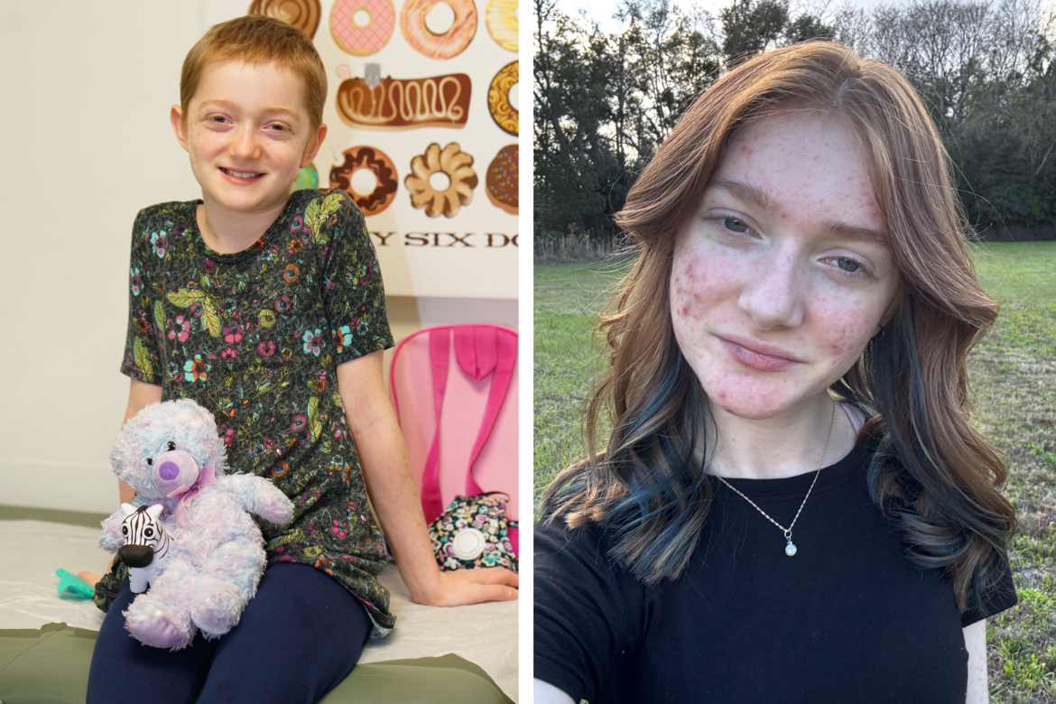 On the left a young child with cropped hair; on the right the same child, a teen
